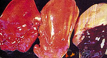 Zakaj se jetra po gojenju debeli v kokoših in se jim je mogoče izogniti?